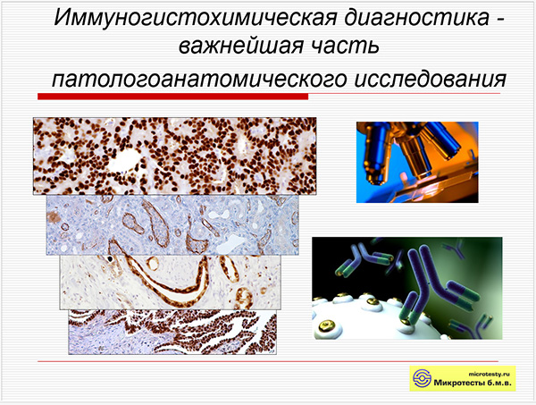 Новые мишени в иммуногистохимической диагностике