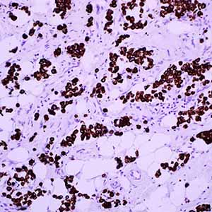 Cytokeratin