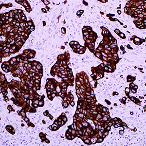 Cytokeratin
