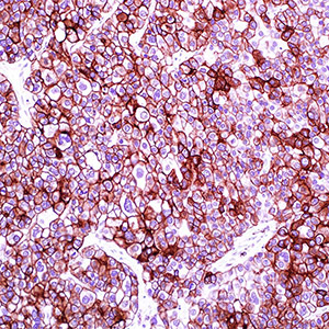 Cytokeratin