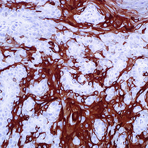 Cytokeratin 10
