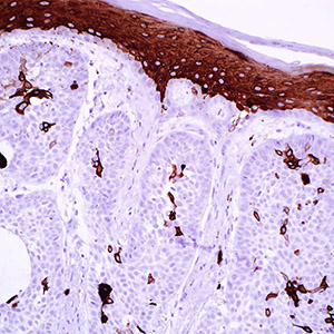 Cytokeratin 10