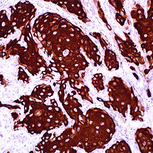 Cytokeratin 10