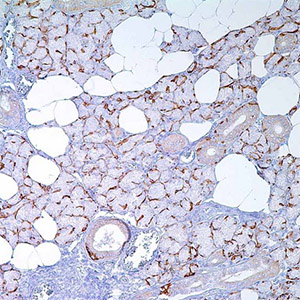 Cytokeratin 14, LL002, mouse