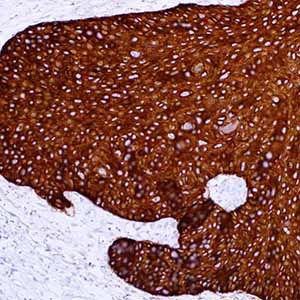 Cytokeratin 14, SP53, rabbit