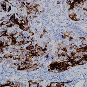 Cytokeratin 14, SP53, rabbit
