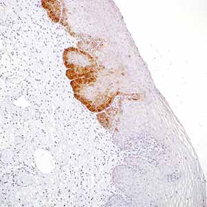 Cytokeratin 17