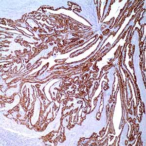 Cytokeratin 19