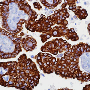 Cytokeratin 19