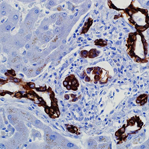 Cytokeratin 19