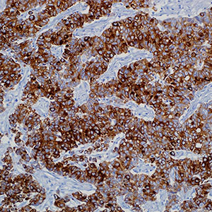 Cytokeratin 20