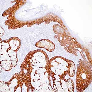 Cytokeratin 5