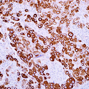 Cytokeratin 5