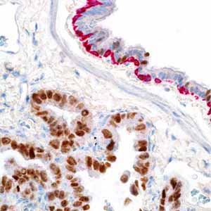 Cytokeratin 5&6