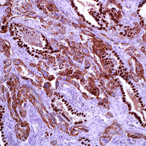 Cytokeratin 5&6