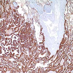 Cytokeratin 7