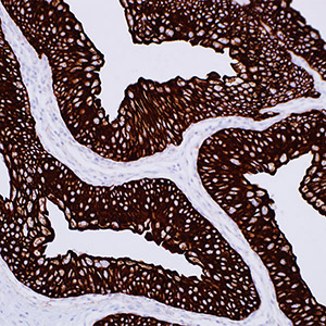 Cytokeratin 7