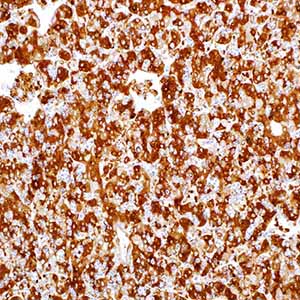Alpha-Fetoprotein