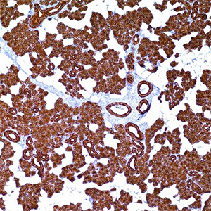 Cytokeratin 8&18