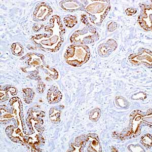 Cytokeratin LMW
