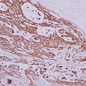 Cytokeratin LMW