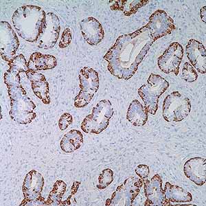 Cytokeratin, 34betaE12, mouse