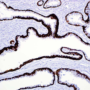 Cytokeratin, 34betaE12, mouse