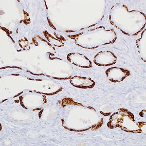 Cytokeratin, 34betaE12, mouse