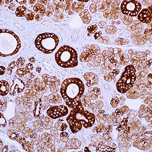 Cytokeratin, 35betaH11, mouse