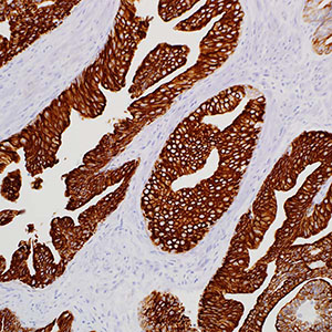 Cytokeratin, 35betaH11, mouse