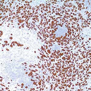 Cytokeratin, 35betaH11, mouse