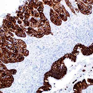 Cytokeratin, OSCAR, mouse