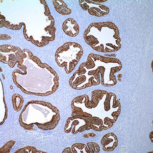 Cytokeratin, OSCAR, mouse