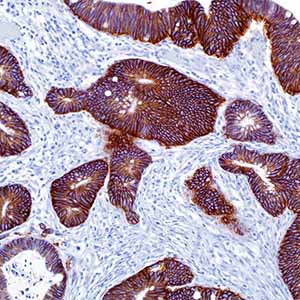Ep-CAM/Epithelial Specific Antigen, Ber-EP4,
mouse