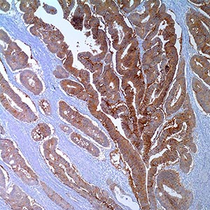 Ep-CAM/Epithelial Specific Antigen, Ber-EP4,
mouse