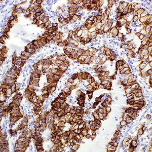 Ep-CAM/Epithelial Specific Antigen, Ber-EP4,
mouse