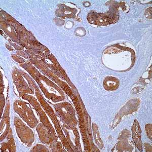 Ep-CAM/Epithelial Specific Antigen, MOC31,
mouse