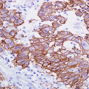 Ep-CAM/Epithelial Specific Antigen, MOC31,
mouse
