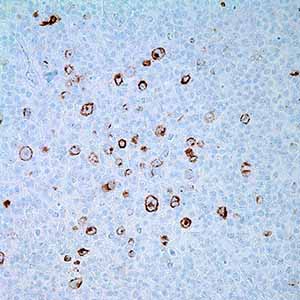 Epstein Barr Virus, CS1-4, mouse