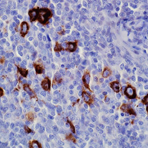 Epstein Barr Virus, CS1-4, mouse