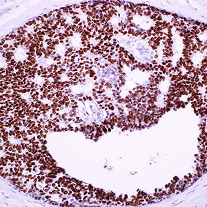 Estrogen Receptor rabbit