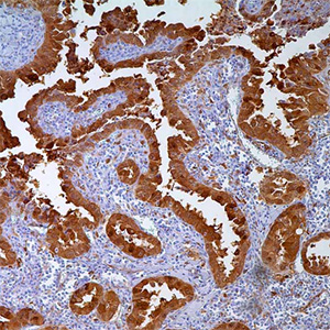 Galectin-3