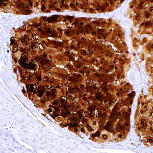 Arginase-1