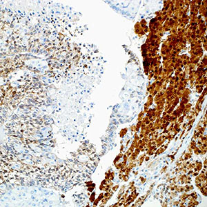 Arginase-1