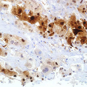 Arginase-1