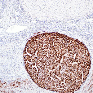 Glutamine synthetase