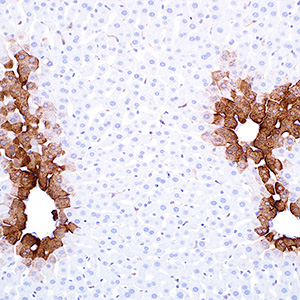 Glutamine synthetase