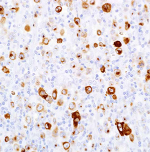 Granzyme B