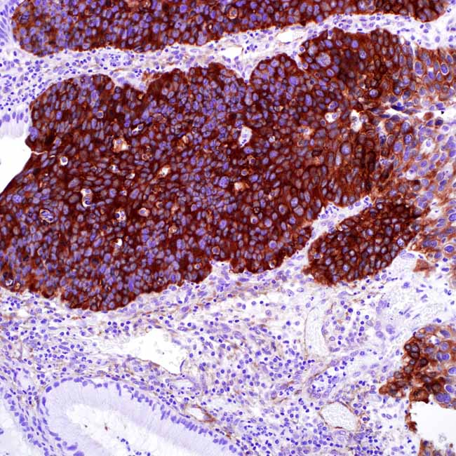 Heat Shock Protein 27
