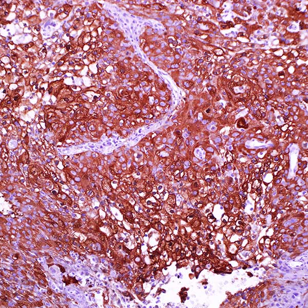 Heat Shock Protein 27